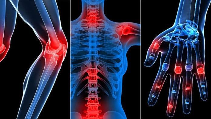 Nước Cốt Nghệ Lên Men Gogwanwon Korea 14 Những vị trí khớp xương dễ tổn thương